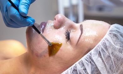 New to Peels? What You Need to Know to Get Comfortable with Chemical Peel Benefits