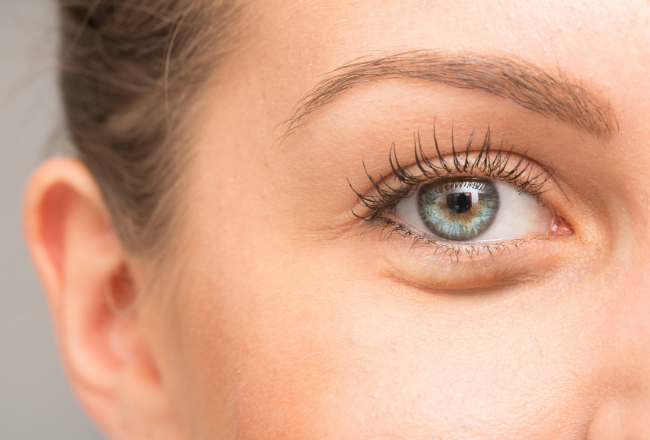How to Get Rid of Bags Under Your Eyes, Tribeca MedSpa