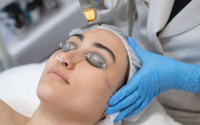 Moxi and BBL Treatments: A Practical Guide to Skin Rejuvenation at Tribeca Medspa