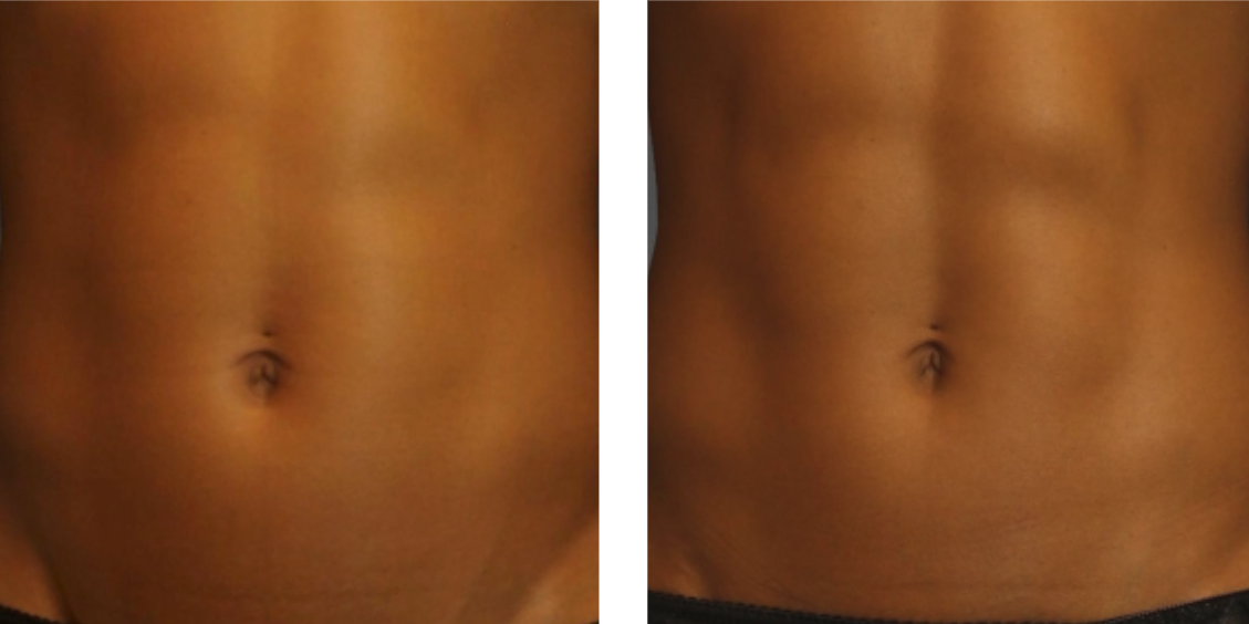 cooltone before after cooltone before after