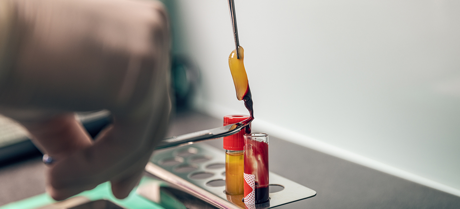 Platelet rich fibrin Platelet rich fibrin