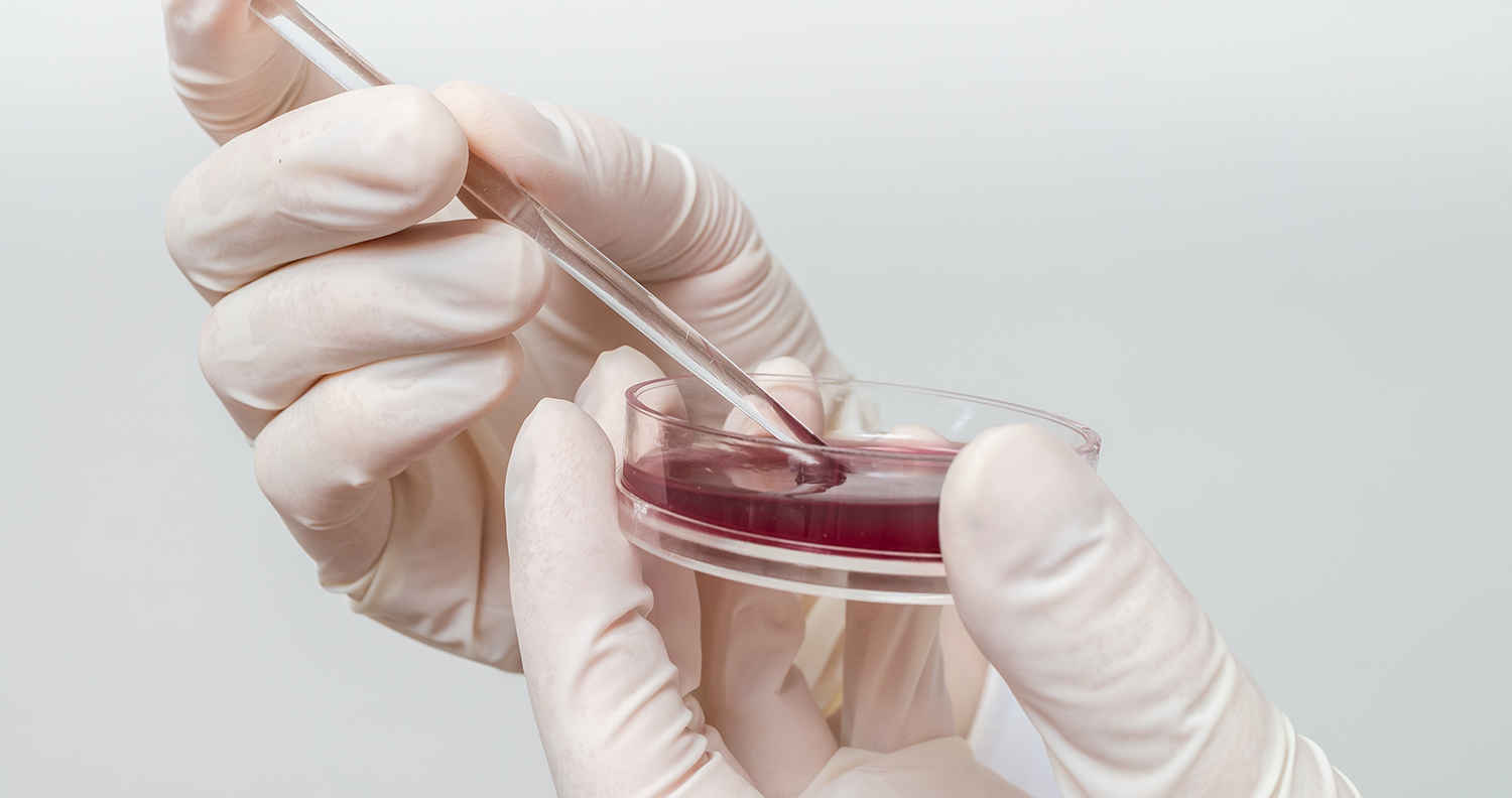 Scientist is analyzing blood sample Scientist is analyzing blood sample