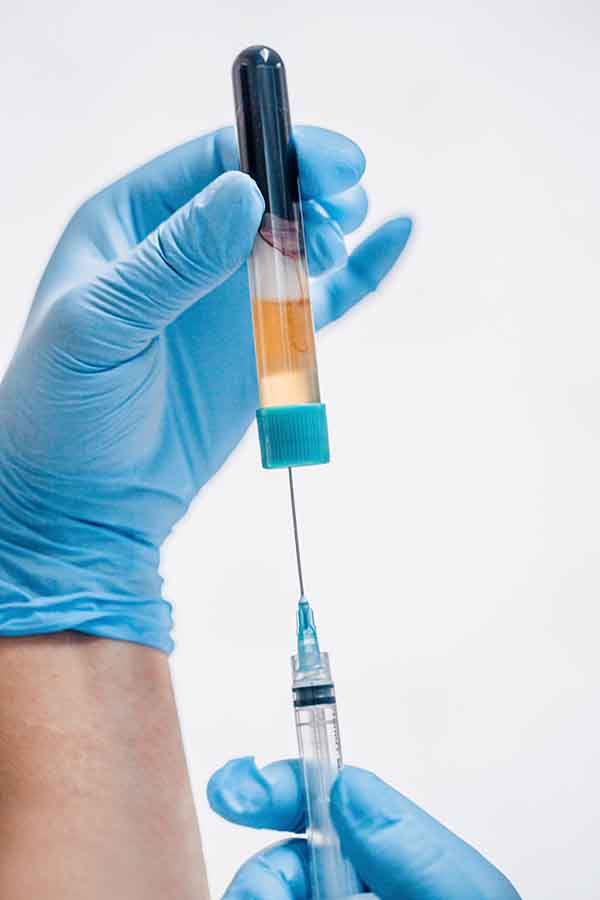 PRF Syringe Injectons