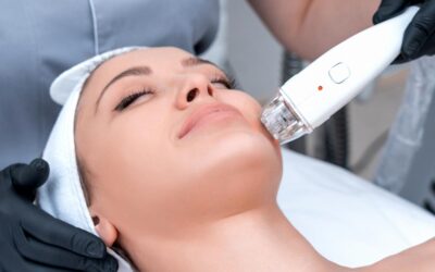 Unveiling Radiant Skin: A Dive into Moxi and BBL with Senior Medical Aesthetician Taryn Johnston at Tribeca Medspa
