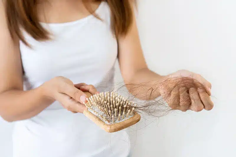 Woman holding hairbrush with excessive hair loss.