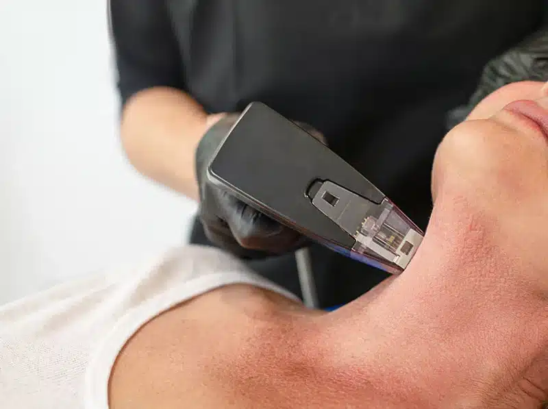 Laser treatment on woman's neck.